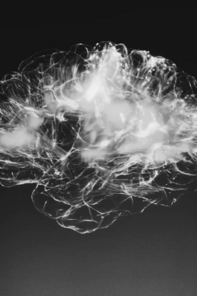 Eine Röntgenaufnahme eines menschlichen Gehirns in Schwarz/Weiß