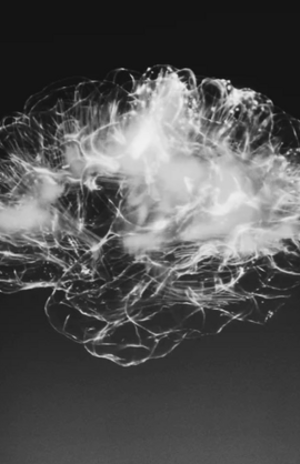 Eine Röntgenaufnahme eines menschlichen Gehirns in Schwarz/Weiß